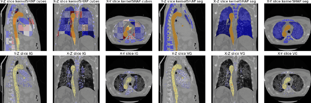 Figure 3 for Aggregated Attributions for Explanatory Analysis of 3D Segmentation Models