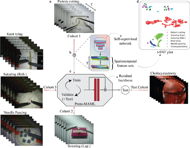 Figure 1 for One-shot domain adaptation in video-based assessment of surgical skills