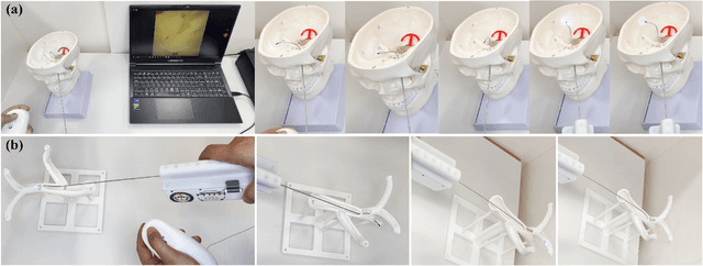Figure 4 for Ultra-slender Coaxial Antagonistic Tubular Robot for Ambidextrous Manipulation