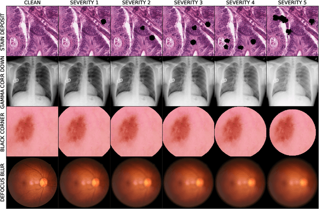 Figure 1 for MedMNIST-C: Comprehensive benchmark and improved classifier robustness by simulating realistic image corruptions