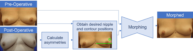Figure 1 for An inpainting approach to manipulate asymmetry in pre-operative breast images