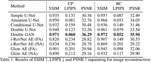 Figure 2 for An inpainting approach to manipulate asymmetry in pre-operative breast images