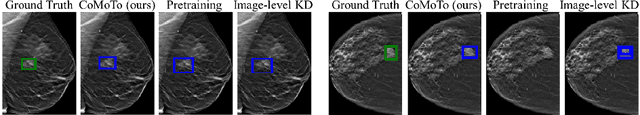 Figure 3 for CoMoTo: Unpaired Cross-Modal Lesion Distillation Improves Breast Lesion Detection in Tomosynthesis