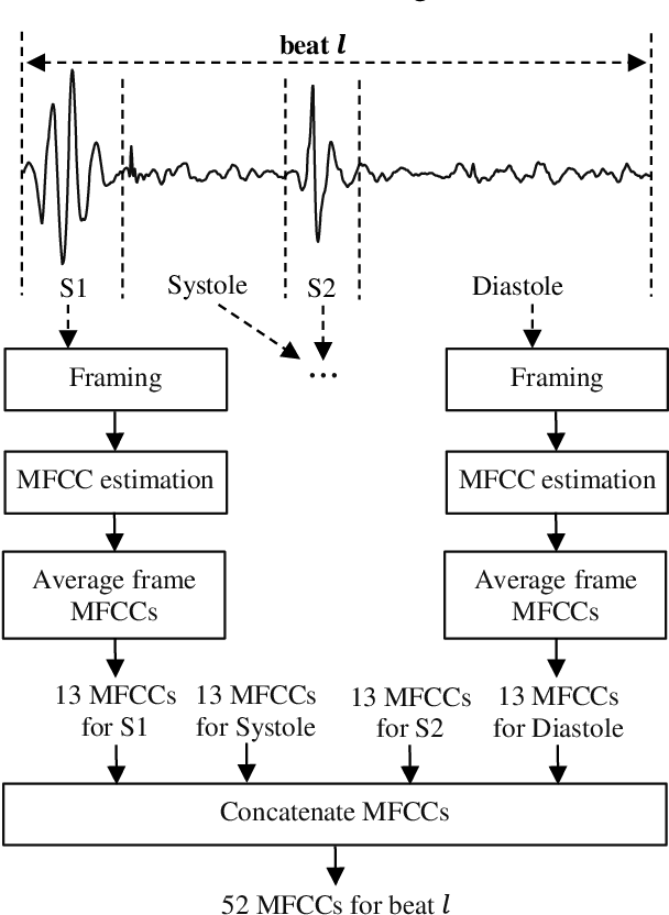 Figure 1 for Enhanced Classification of Heart Sounds Using Mel Frequency Cepstral Coefficients: A Comparative Study of Single and Ensemble Classifier Strategies