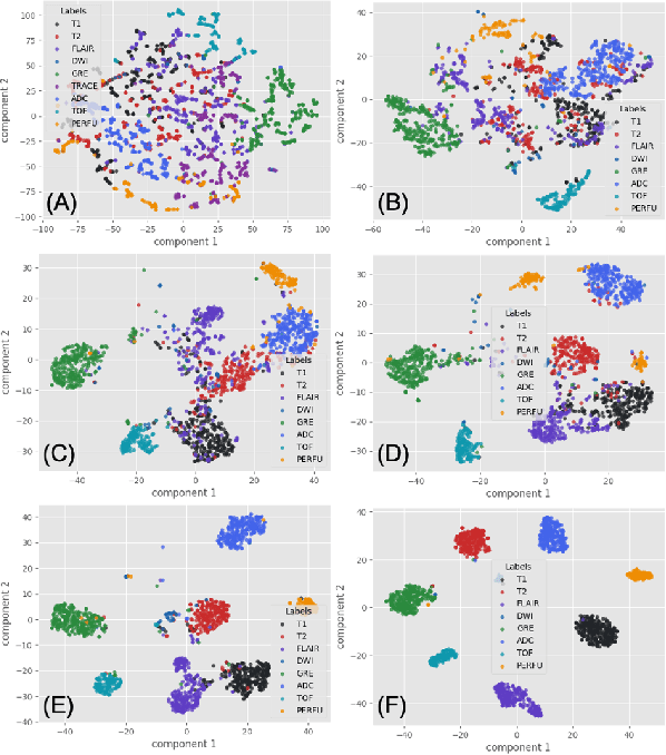 Figure 3 for Evaluating unsupervised contrastive learning framework for MRI sequences classification