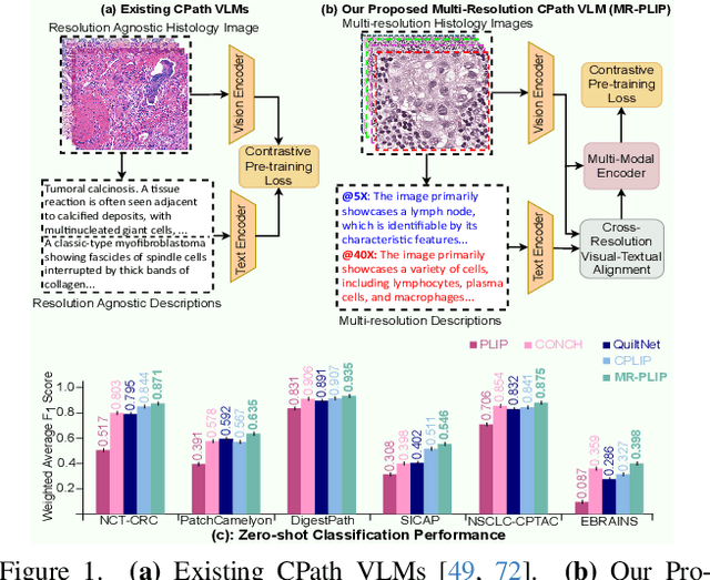 Figure 1 for Multi-Resolution Pathology-Language Pre-training Model with Text-Guided Visual Representation