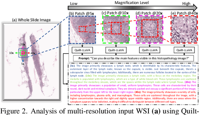 Figure 3 for Multi-Resolution Pathology-Language Pre-training Model with Text-Guided Visual Representation