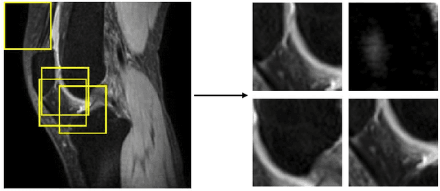 Figure 3 for Utilizing 3D Fast Spin Echo Anatomical Imaging to Reduce the Number of Contrast Preparations in $T_{1ρ}$ Quantification of Knee Cartilage Using Learning-Based Methods