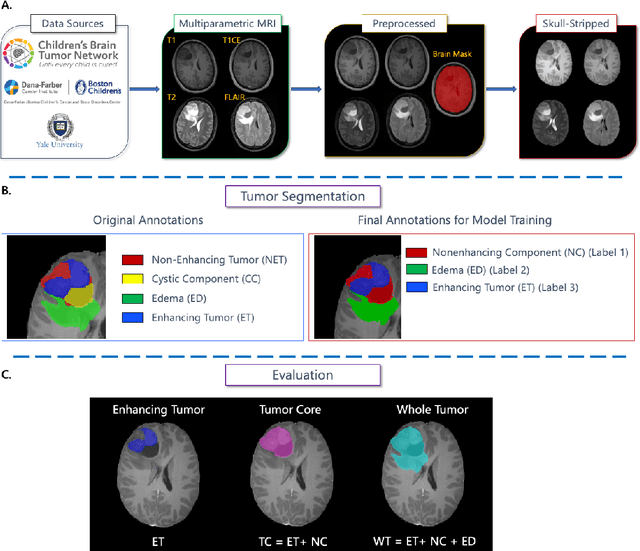 Figure 1 for BraTS-PEDs: Results of the Multi-Consortium International Pediatric Brain Tumor Segmentation Challenge 2023