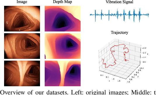 Figure 4 for V$^2$-SfMLearner: Learning Monocular Depth and Ego-motion for Multimodal Wireless Capsule Endoscopy