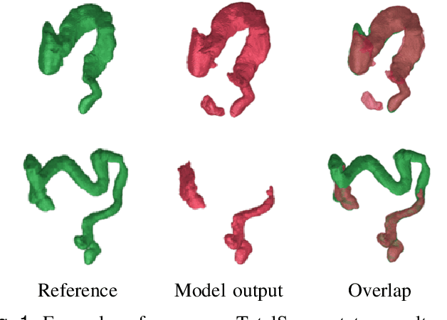 Figure 1 for Large Intestine 3D Shape Refinement Using Point Diffusion Models for Digital Phantom Generation