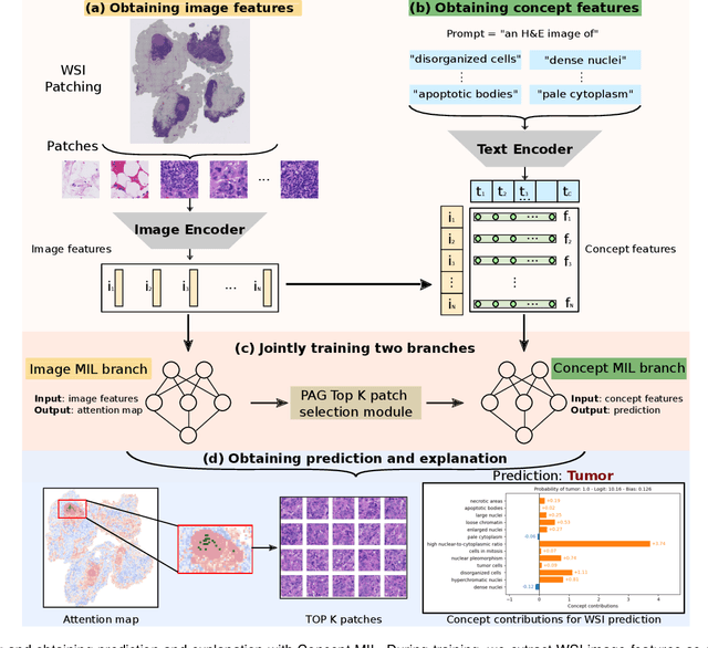 Figure 1 for Label-free Concept Based Multiple Instance Learning for Gigapixel Histopathology