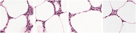 Figure 2 for Label-free Concept Based Multiple Instance Learning for Gigapixel Histopathology