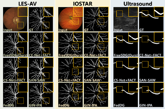 Figure 4 for Frequency-mixed Single-source Domain Generalization for Medical Image Segmentation