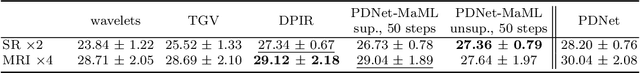 Figure 2 for Meta-Prior: Meta learning for Adaptive Inverse Problem Solvers