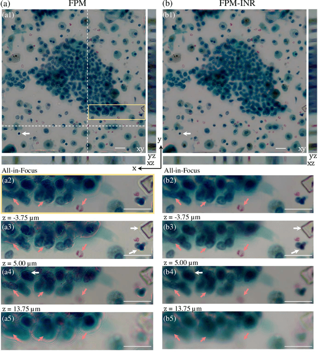 Figure 4 for FPM-INR: Fourier ptychographic microscopy image stack reconstruction using implicit neural representations