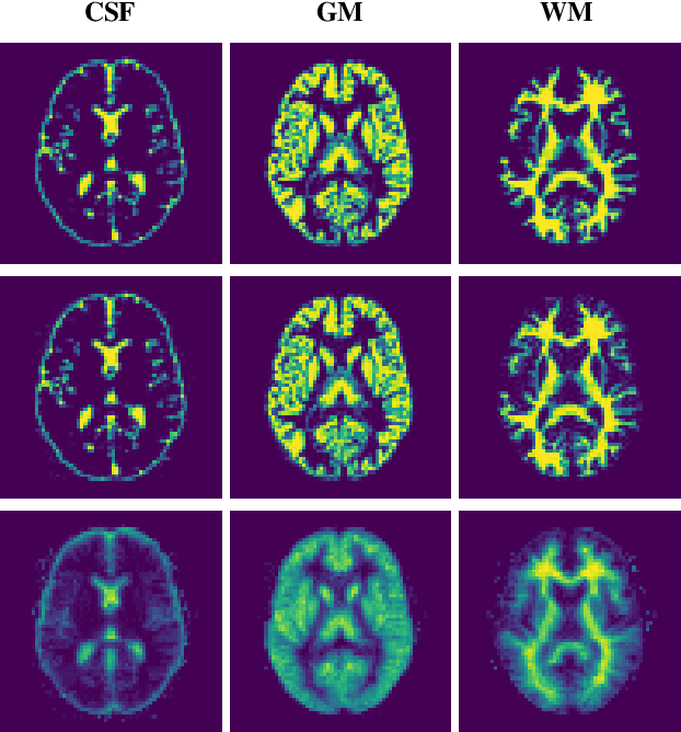 Figure 3 for BMapOpt: Optimization of Brain Tissue Probability Maps using a Differentiable MRI Simulator