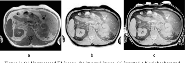 Figure 1 for Improve Cross-Modality Segmentation by Treating MRI Images as Inverted CT Scans