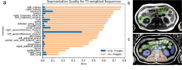 Figure 3 for Improve Cross-Modality Segmentation by Treating MRI Images as Inverted CT Scans