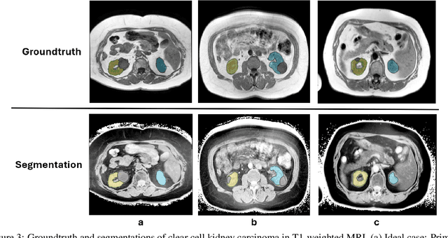 Figure 4 for Improve Cross-Modality Segmentation by Treating MRI Images as Inverted CT Scans