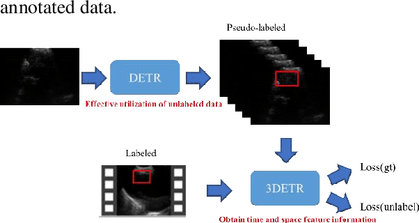 Figure 1 for Towards Enhanced Analysis of Lung Cancer Lesions in EBUS-TBNA -- A Semi-Supervised Video Object Detection Method