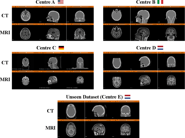 Figure 2 for FedSynthCT-Brain: A Federated Learning Framework for Multi-Institutional Brain MRI-to-CT Synthesis