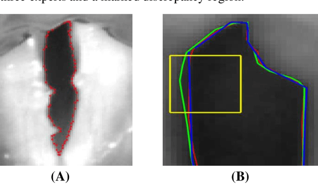 Figure 2 for Experimental Framework for Generating Reliable Ground Truth for Laryngeal Spatial Segmentation Tasks