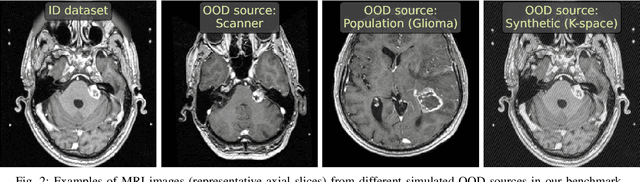 Figure 2 for Limitations of Out-of-Distribution Detection in 3D Medical Image Segmentation