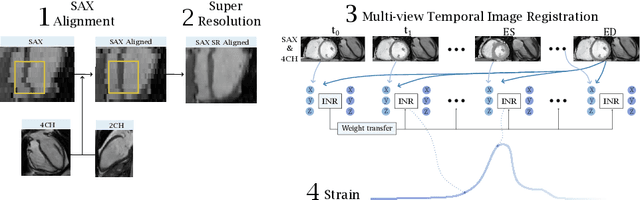Figure 1 for Deep Learning for Automatic Strain Quantification in Arrhythmogenic Right Ventricular Cardiomyopathy
