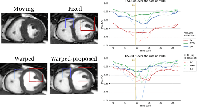 Figure 4 for Deep Learning for Automatic Strain Quantification in Arrhythmogenic Right Ventricular Cardiomyopathy