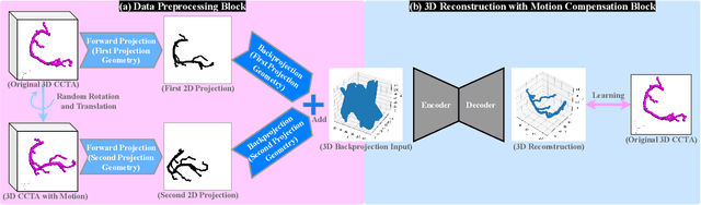Figure 1 for Deep Learning-based 3D Coronary Tree Reconstruction from Two 2D Non-simultaneous X-ray Angiography Projections