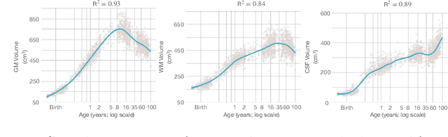 Figure 4 for Brain Tissue Segmentation Across the Human Lifespan via Supervised Contrastive Learning