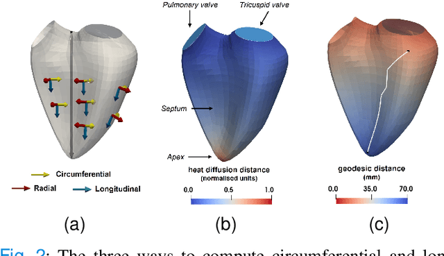 Figure 3 for High-dimensional multimodal uncertainty estimation by manifold alignment:Application to 3D right ventricular strain computations