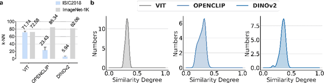 Figure 1 for Pre-trained Models Succeed in Medical Imaging with Representation Similarity Degradation