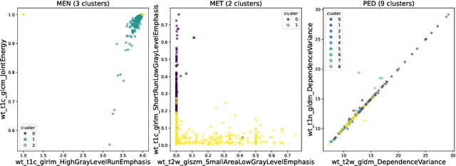 Figure 3 for Adaptable Segmentation Pipeline for Diverse Brain Tumors with Radiomic-guided Subtyping and Lesion-Wise Model Ensemble