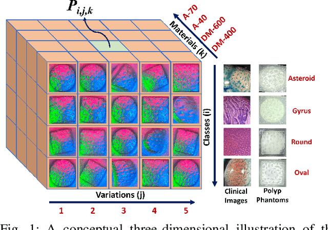 Figure 1 for Towards Reliable Colorectal Cancer Polyps Classification via Vision Based Tactile Sensing and Confidence-Calibrated Neural Networks