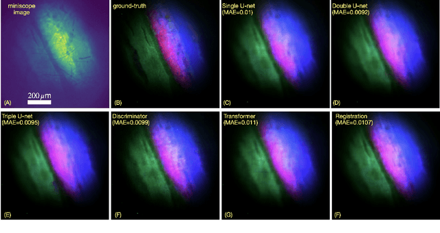 Figure 4 for HAMscope: a snapshot Hyperspectral Autofluorescence Miniscope for real-time molecular imaging