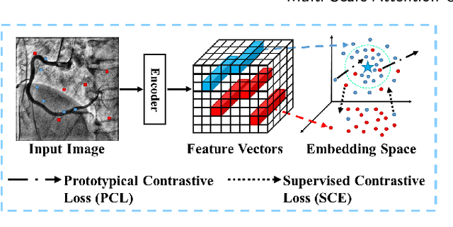 Figure 1 for MSA-UNet3+: Multi-Scale Attention UNet3+ with New Supervised Prototypical Contrastive Loss for Coronary DSA Image Segmentation