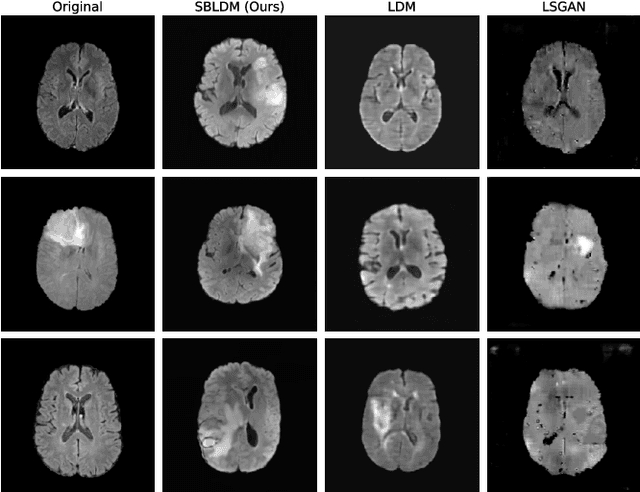 Figure 3 for 3D MRI Synthesis with Slice-Based Latent Diffusion Models: Improving Tumor Segmentation Tasks in Data-Scarce Regimes