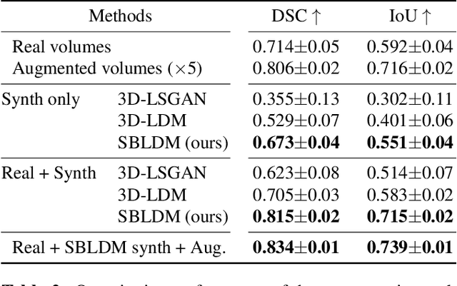 Figure 4 for 3D MRI Synthesis with Slice-Based Latent Diffusion Models: Improving Tumor Segmentation Tasks in Data-Scarce Regimes
