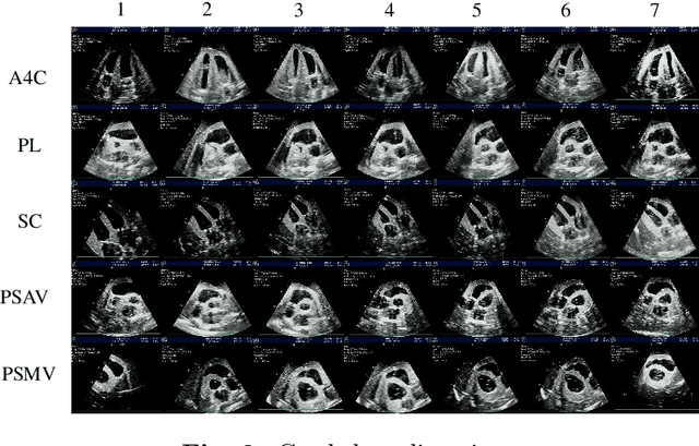Figure 3 for CACTUS: An Open Dataset and Framework for Automated Cardiac Assessment and Classification of Ultrasound Images Using Deep Transfer Learning