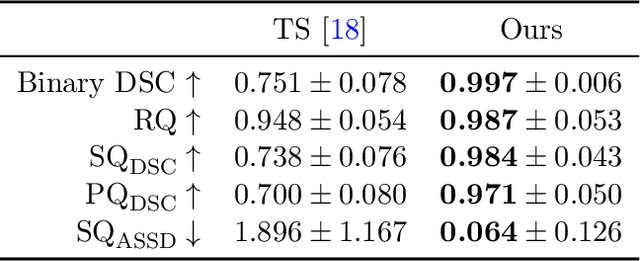 Figure 4 for Automated Thoracolumbar Stump Rib Detection and Analysis in a Large CT Cohort