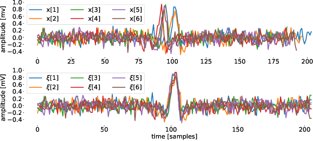 Figure 1 for A Data-Driven Gaussian Process Filter for Electrocardiogram Denoising
