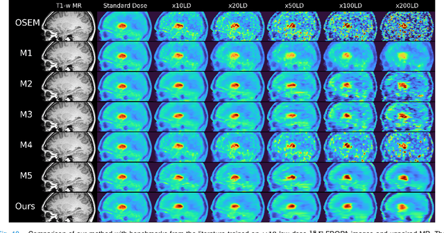 Figure 2 for Deep kernel representations of latent space features for low-dose PET-MR imaging robust to variable dose reduction