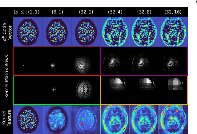 Figure 4 for Deep kernel representations of latent space features for low-dose PET-MR imaging robust to variable dose reduction