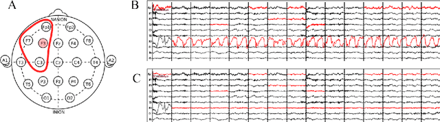 Figure 2 for A Hybrid Artificial Intelligence System for Automated EEG Background Analysis and Report Generation