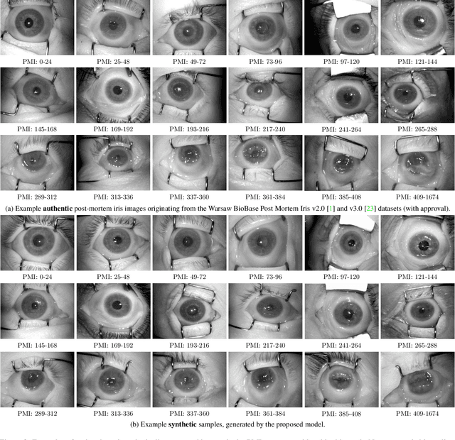 Figure 4 for Forensic Iris Image Synthesis