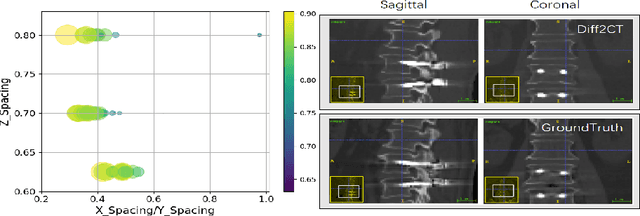 Figure 3 for Reconstruct Spine CT from Biplanar X-Rays via Diffusion Learning