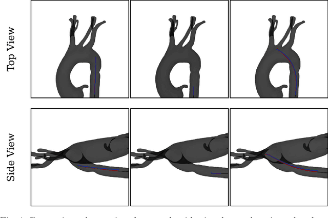 Figure 4 for 3D Guidewire Shape Reconstruction from Monoplane Fluoroscopic Images