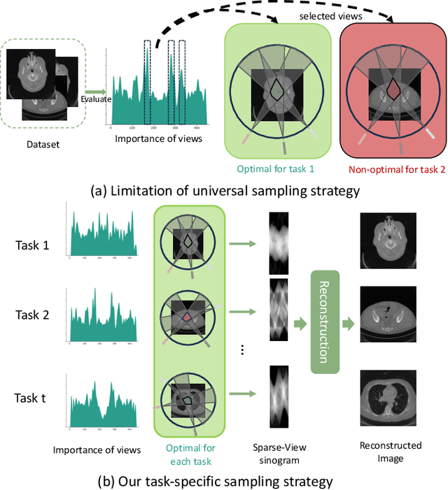 Figure 1 for Learning Task-Specific Sampling Strategy for Sparse-View CT Reconstruction